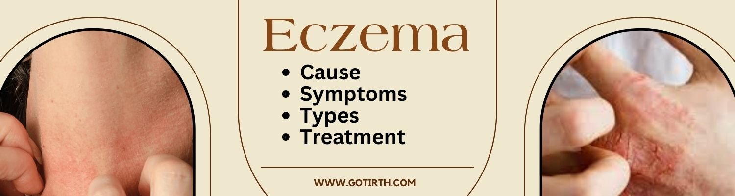 Eczema Care Simplified: Triggers, Symptoms, and Solutions